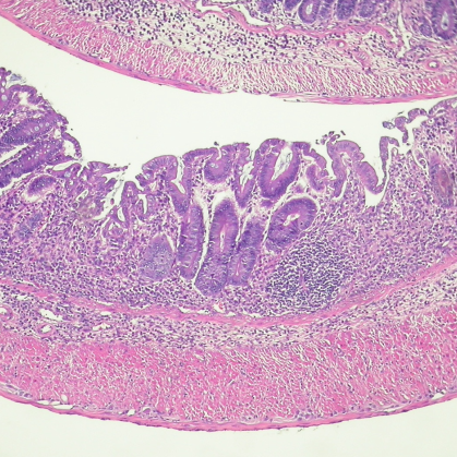 RES AREA - INFLAMMATORY